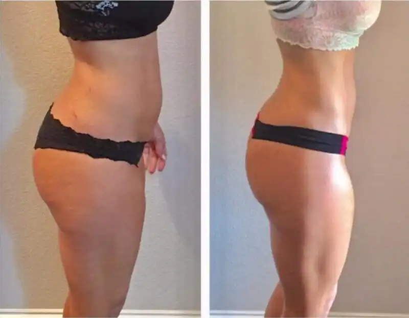 6 Slim Pod Treatments