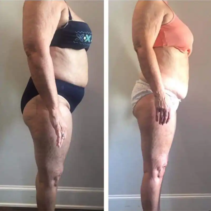6 Slim Pod Treatments