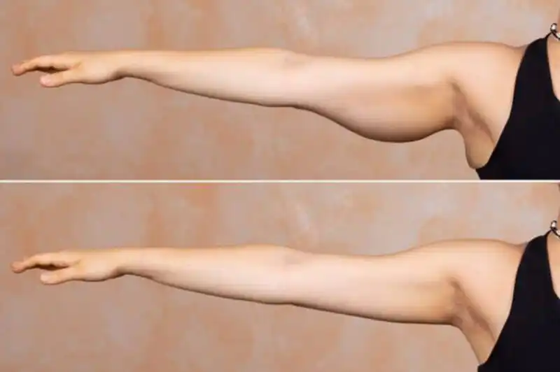 Amazing for Arms