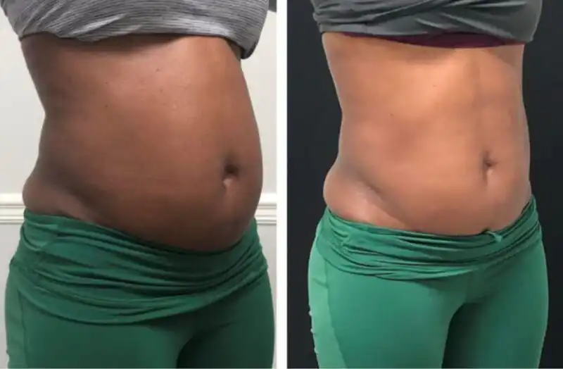 Stomach Much Flatter