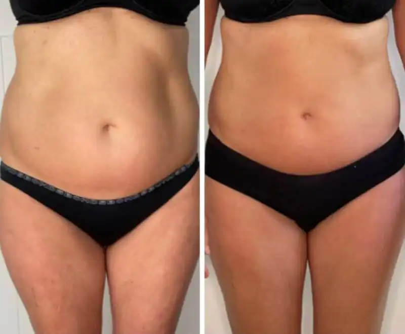 Works on Abs!