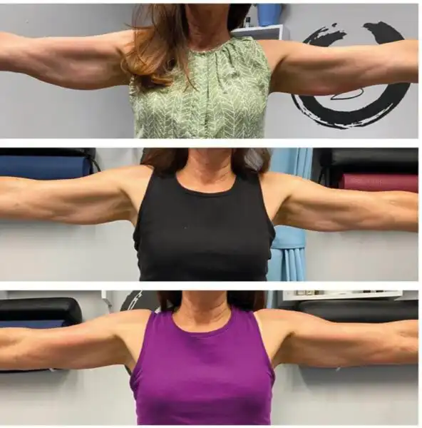 Works on Arms!