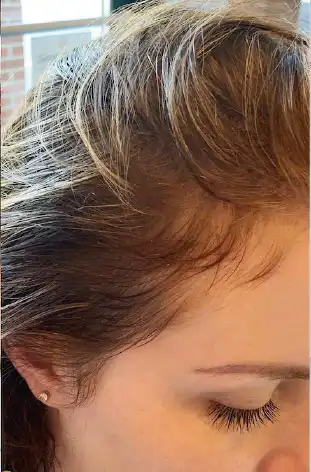 Mesojet Makeover After