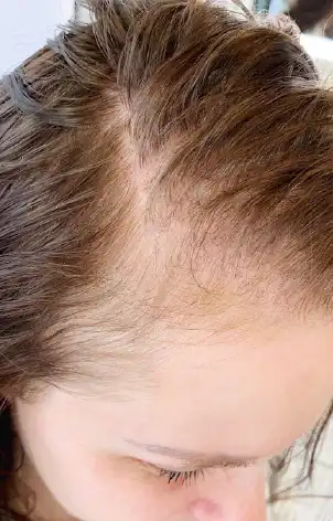 Mesojet Makeover Before
